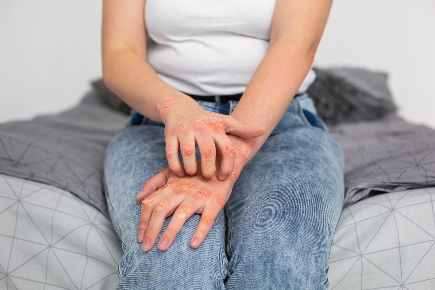 Día Mundial de las Enfermedades Huérfanas: visibilizar lo poco común para no dejar a nadie atrás