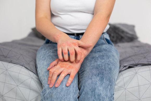 Día Mundial de las Enfermedades Huérfanas: visibilizar lo poco común para no dejar a nadie atrás