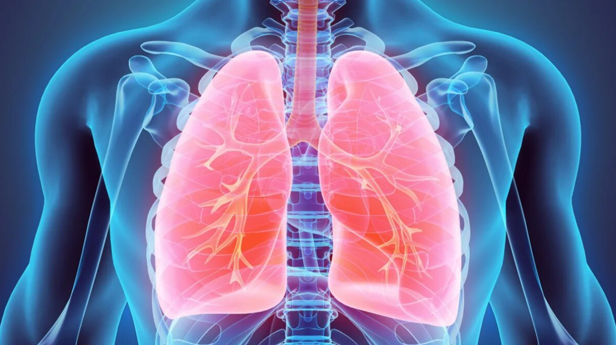 EPOC: Enfermedad Pulmonar Obstructiva Crónica - Un Desafío Respiratorio