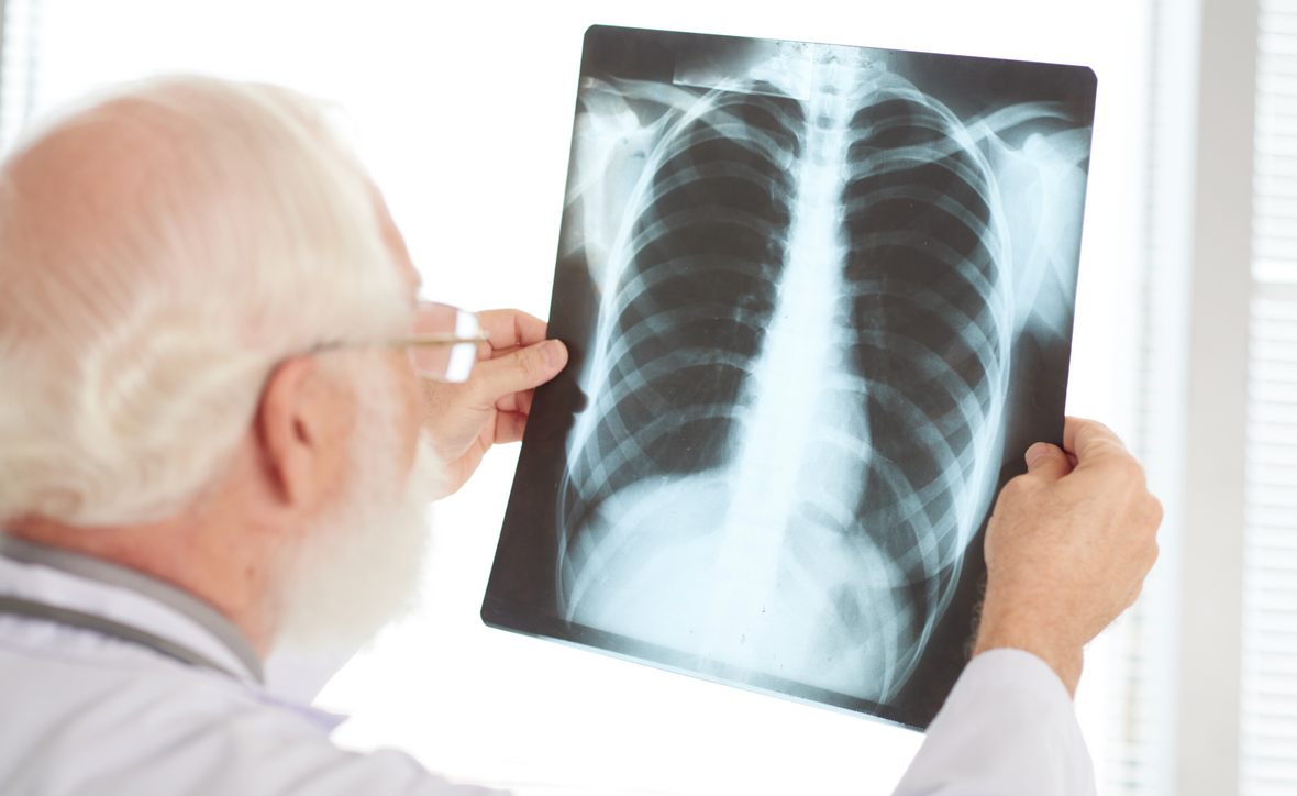 Día Internacional de la Tuberculosis: Concienciación, Prevención y Tratamiento