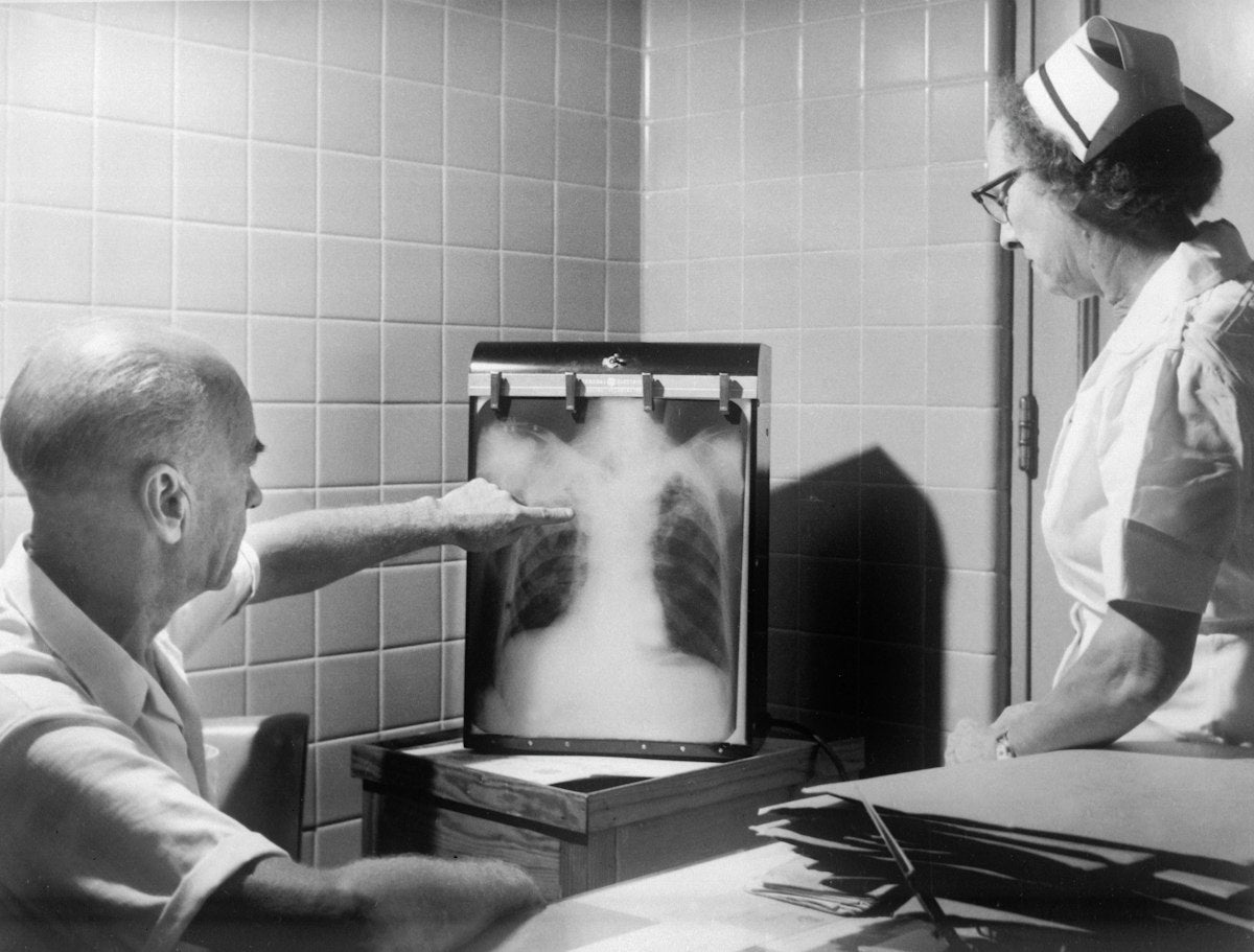 Médicos revisando una radiografía de tórax